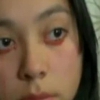 Bizarr! Vért sír egy chilei nő