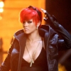 Rihanna megégette magát