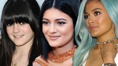 Döbbenetes: Ennyit változott Kylie Jenner arca az elmúlt években!