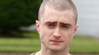 Hová tűnt Daniel Radcliffe haja?