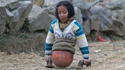 Kosárlabdával helyettesítette balesetben elvesztett lábait a tragikus sorsú lány – inspiráló történet!
