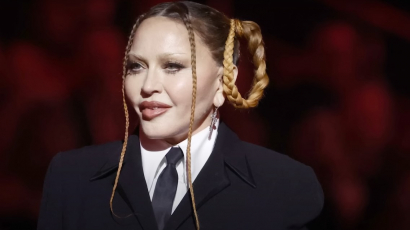 Lement Madonna arcáról a duzzanat - Így néz ki most az énekesnő