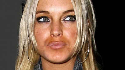 Lindsay Lohan ismét plasztikáztatott