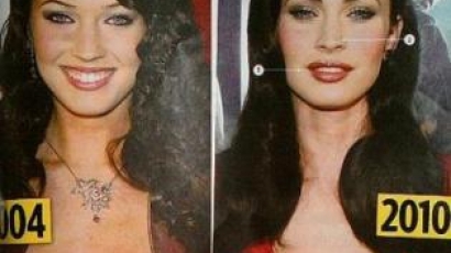 Megan Fox plasztikai műtéteken esett át?