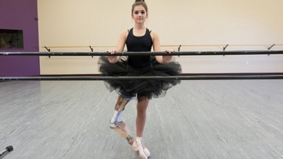 Megható történet: Elveszítette a fél lábát a balerina, mégsem adta fel az álmát