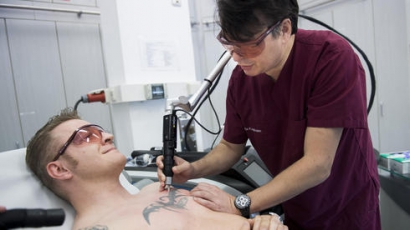 10 perc alatt eltávolítható a tetoválás